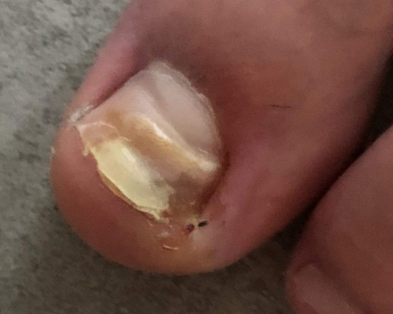 Med pedicure 