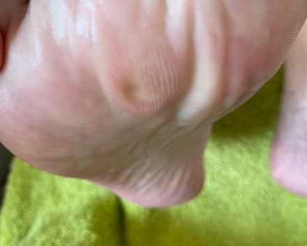 Med pedicure 